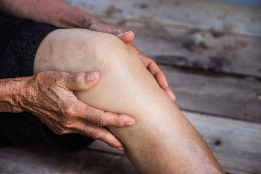 osteoartritis qué es